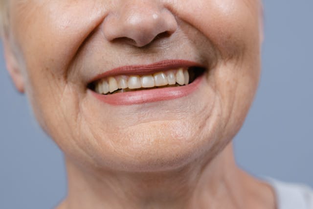 שיקום שיניים במבוגרים: אתגרים ופתרונות